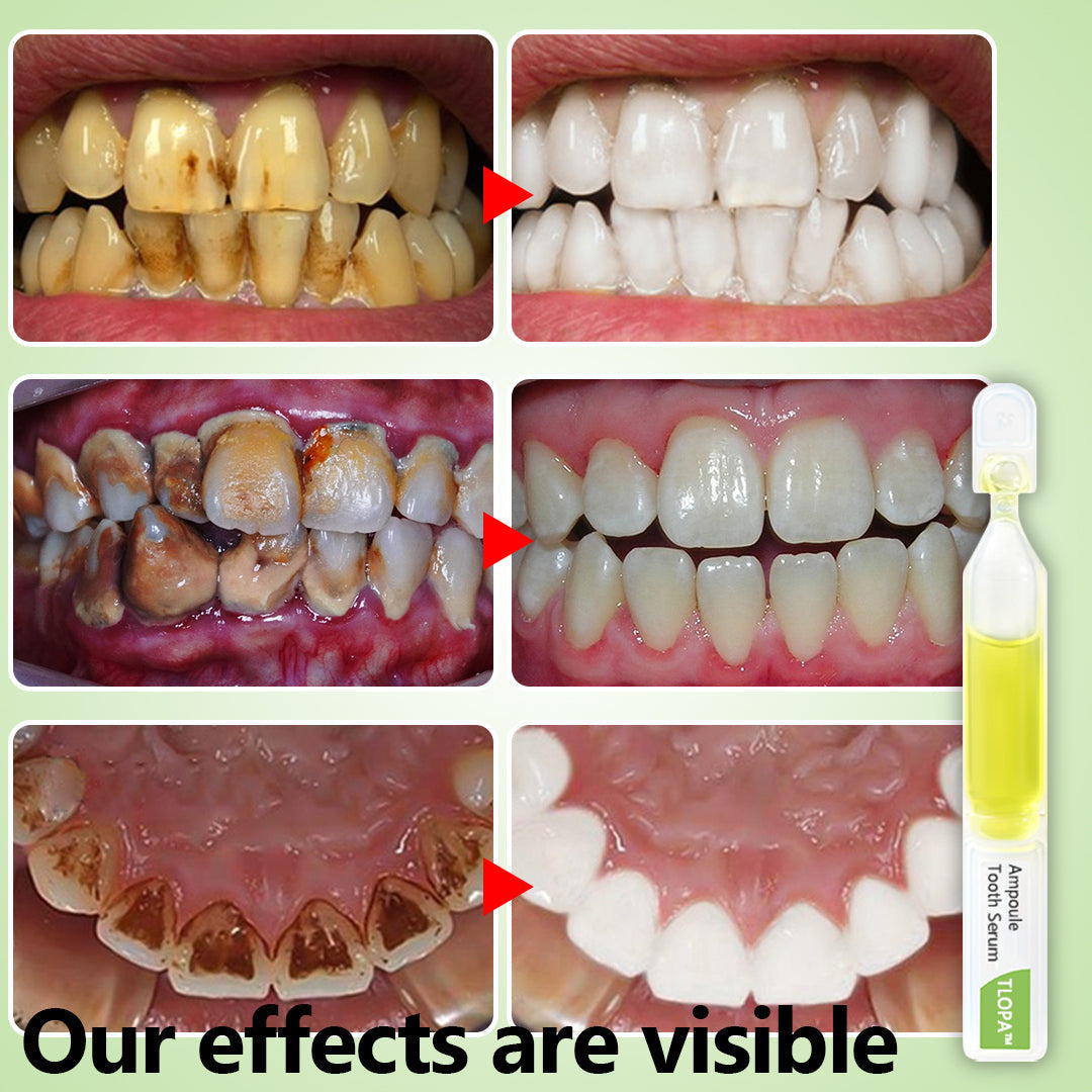 🔥TLOPA™ Ampoule Toothpaste(for all kinds of dental problems, including cosmetic and rejuvenation)