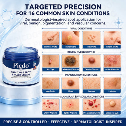 𝐏𝐡𝐚𝐫𝐦𝐚𝐜𝐢𝐬𝐭 𝐑𝐞𝐜𝐨𝐦𝐦𝐞𝐧𝐝𝐞𝐝 ✅𝐏𝐢𝐜𝐝𝐨® 7-𝐃𝐚𝐲 𝐒𝐤𝐢𝐧 𝐓𝐚𝐠 & 𝐒𝐩𝐨𝐭 𝐄𝐫𝐚𝐬𝐞𝐫 𝐂𝐫𝐞𝐚𝐦 🧴(Zero Pain, Zero 𝐒𝐜𝐚𝐫𝐬 Formula) 💪