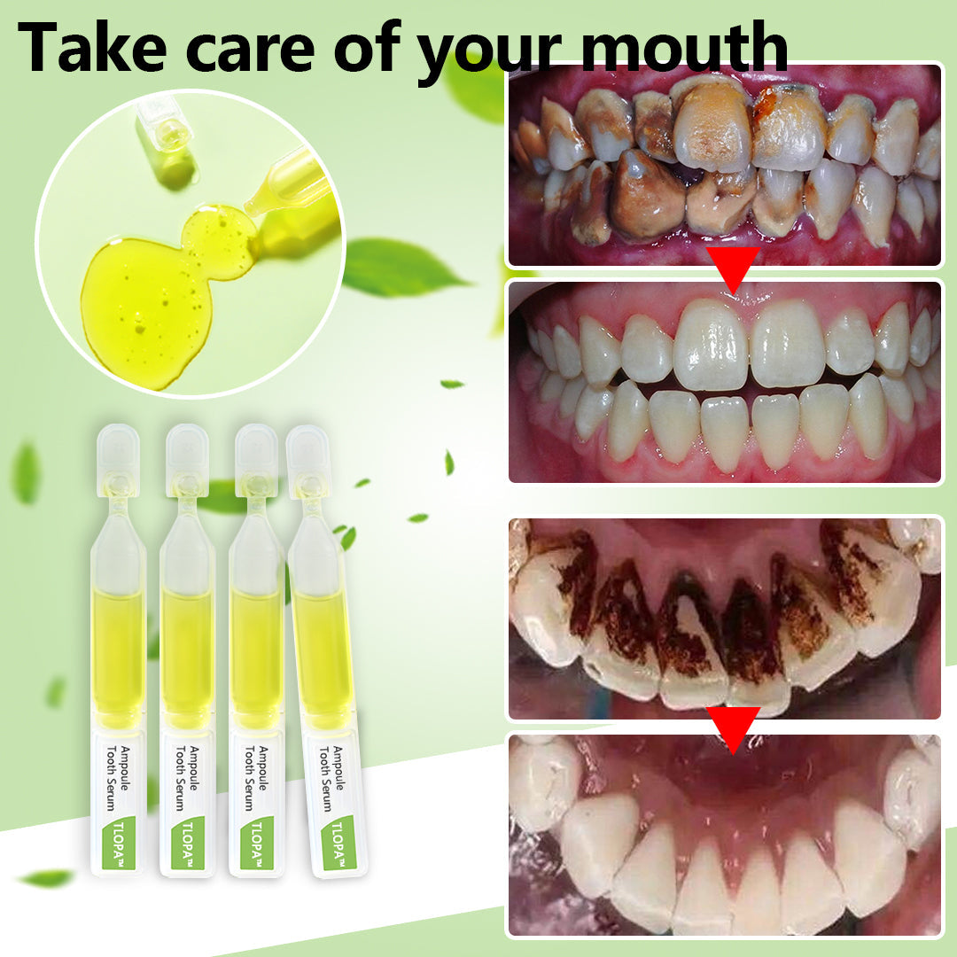 💥TLOPA™ Ampoule Toothpaste, Removal of tartar and plaque bacteria and various oral problems