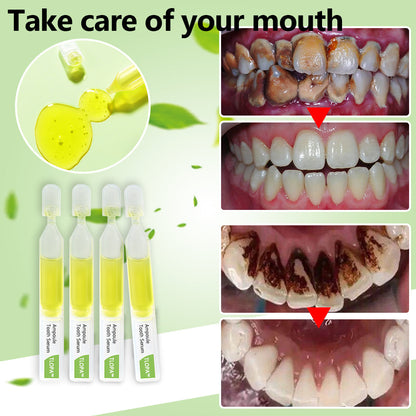 💥TLOPA™ Ampoule Toothpaste, Removal of tartar and plaque bacteria and various oral problems